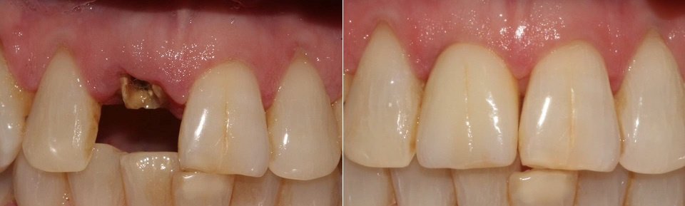 Precision Dental Clinic - Oldham - Precision Dental Clinic - Oldham