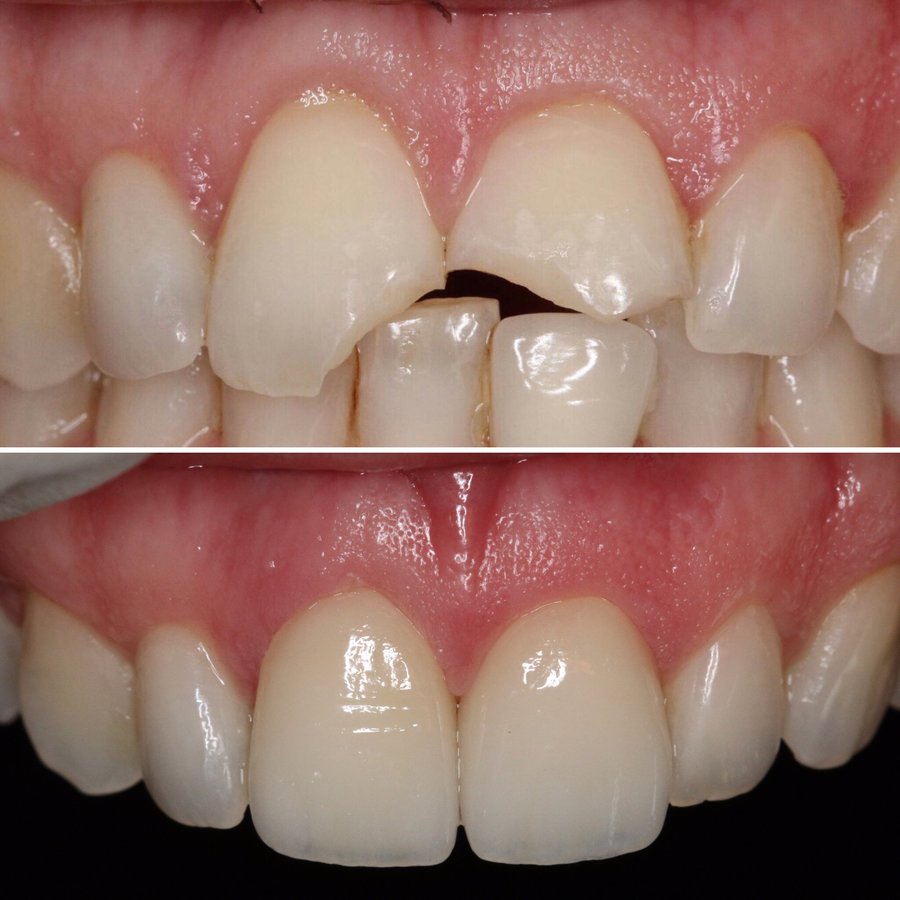 Precision Dental Clinic - Stockport - Precision Dental Clinic - Stockport