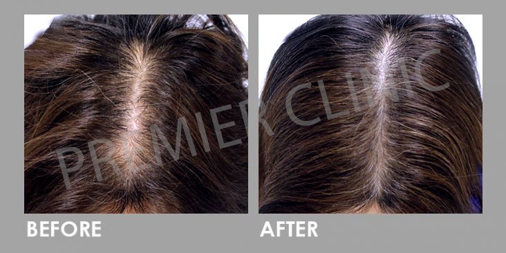 Premier Clinic - Bangsar - Premier Clinic - Bangsar