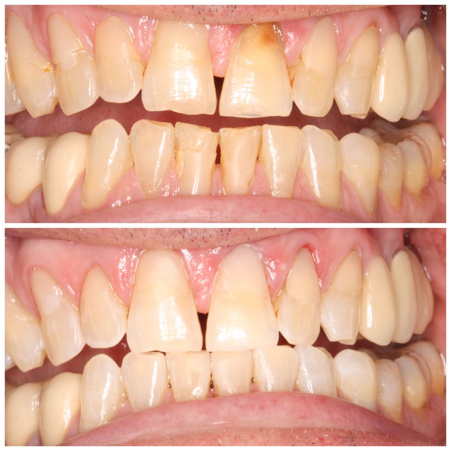 Premier Dental Care Solutions - Premier Dental Care Solutions