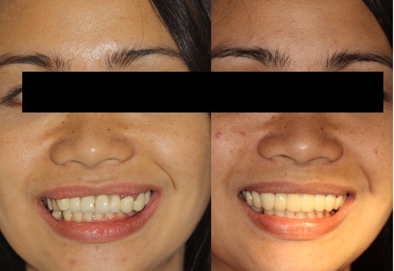 Premier Dental Care Solutions - Premier Dental Care Solutions