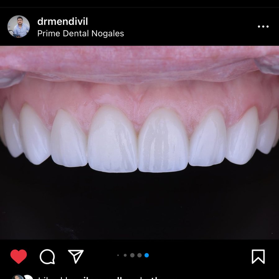 Prime Dental Nogales - Dr Nehemias Mendivil - Prime Dental Nogales - Dr Nehemias Mendivil