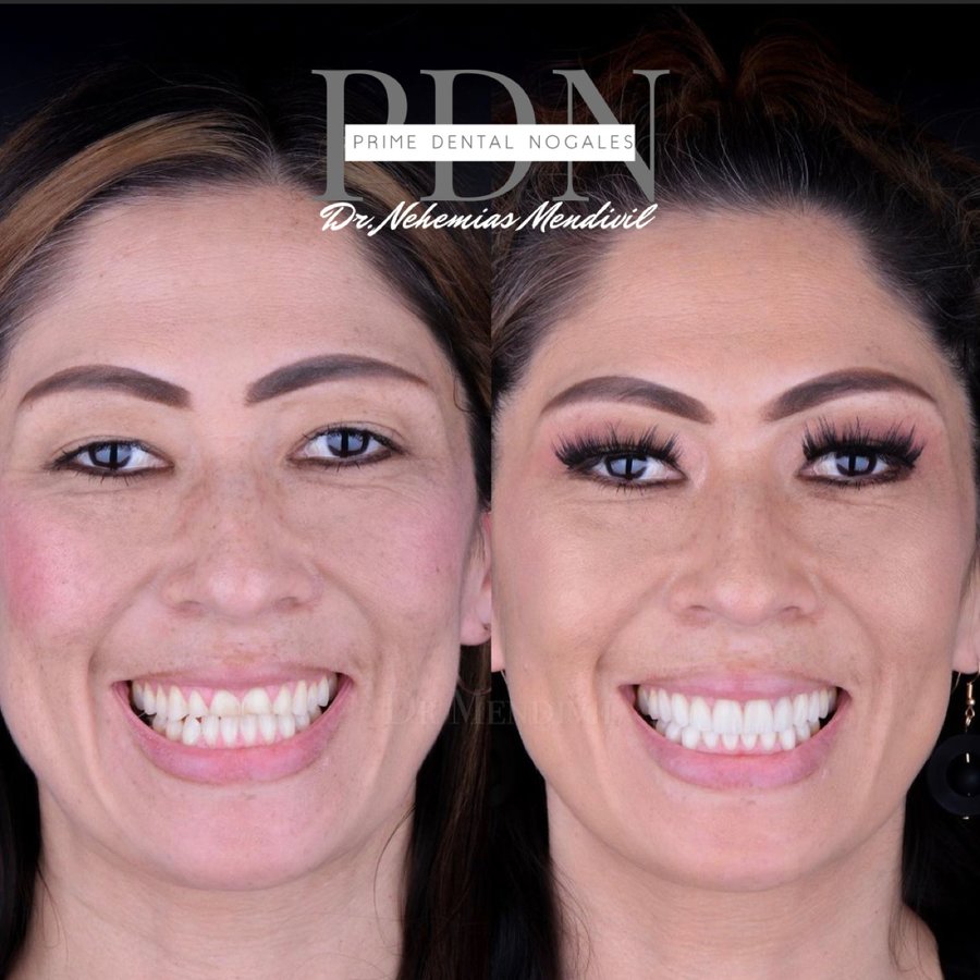 Prime Dental Nogales - Dr Nehemias Mendivil - Prime Dental Nogales - Dr Nehemias Mendivil