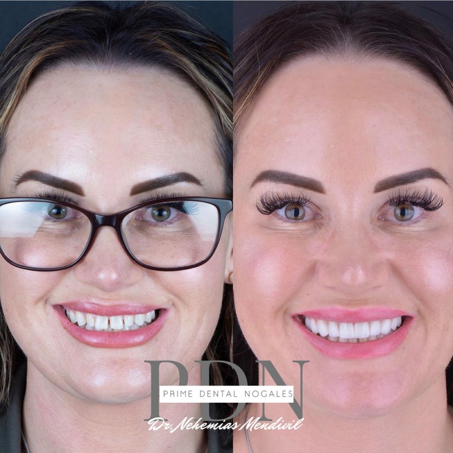 Prime Dental Nogales - Dr Nehemias Mendivil - Prime Dental Nogales - Dr Nehemias Mendivil