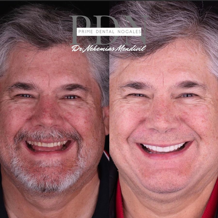 Prime Dental Nogales - Dr Nehemias Mendivil - Prime Dental Nogales - Dr Nehemias Mendivil