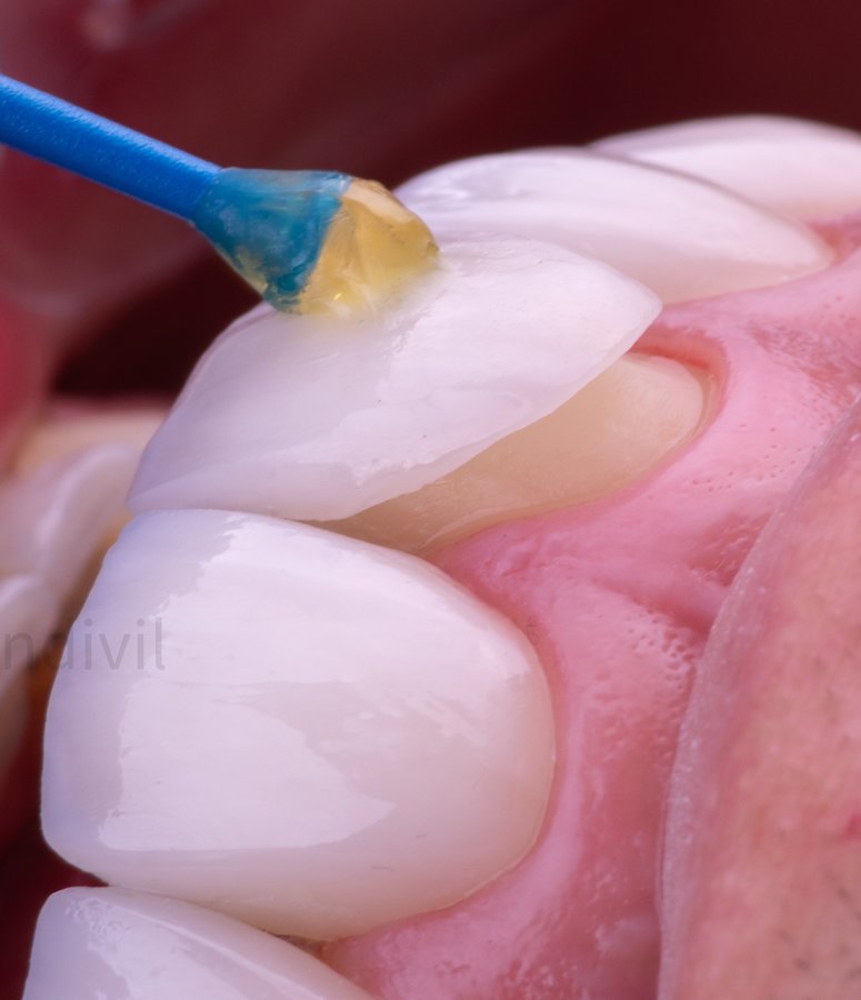 Prime Dental Nogales - Dr Nehemias Mendivil - Prime Dental Nogales - Dr Nehemias Mendivil