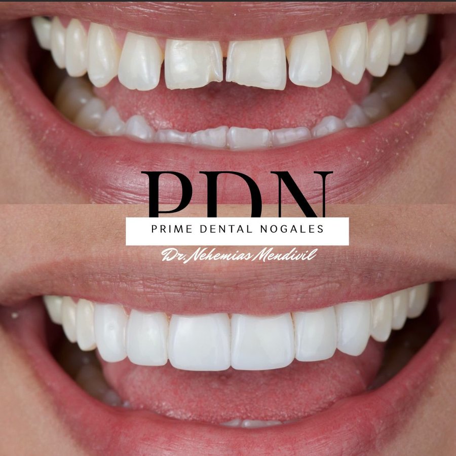 Prime Dental Nogales - Dr Nehemias Mendivil - Prime Dental Nogales - Dr Nehemias Mendivil