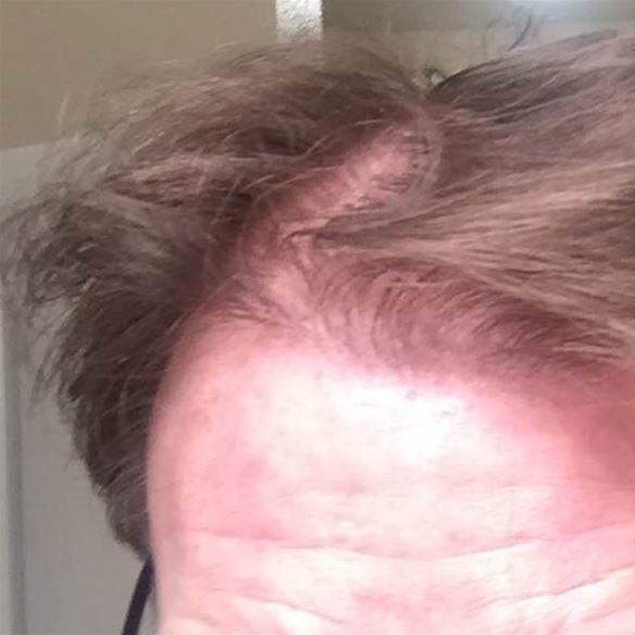 Pro Hair Transplant Clinic - Pro Hair Transplant Clinic