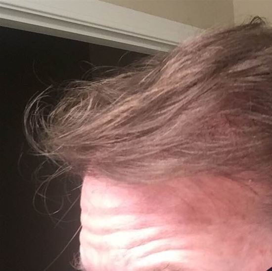 Pro Hair Transplant Clinic - Pro Hair Transplant Clinic