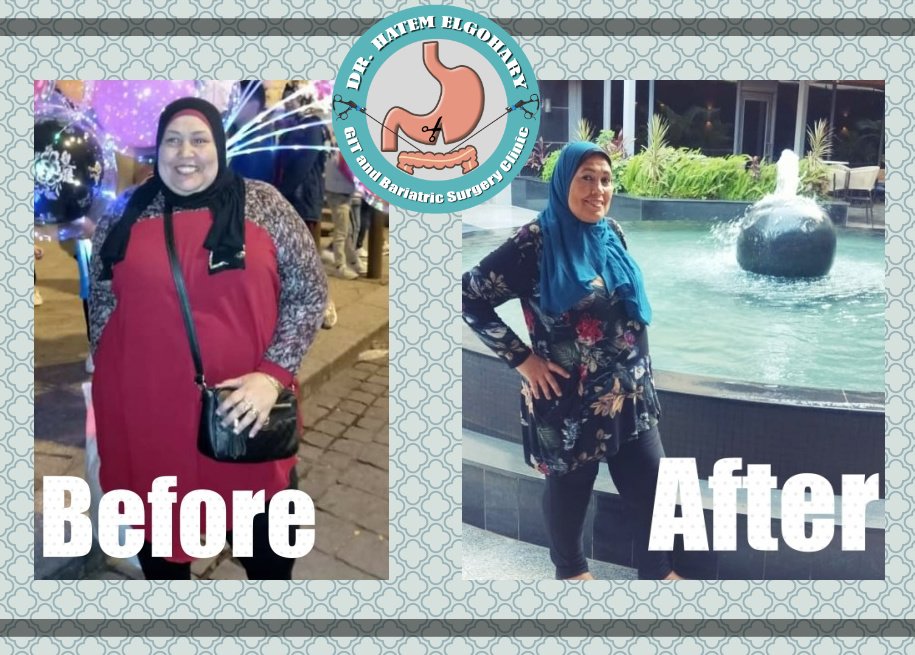 Professor Dr Hatem Elgohary (GIT and Bariatric Surgery) - Professor Dr Hatem Elgohary (GIT and Bariatric Surgery)