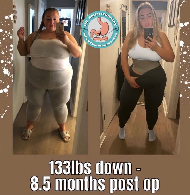 Professor Dr Hatem Elgohary (GIT and Bariatric Surgery) - Professor Dr Hatem Elgohary (GIT and Bariatric Surgery)