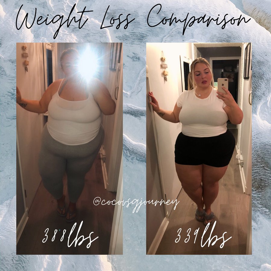 Professor Dr Hatem Elgohary (GIT and Bariatric Surgery) - Professor Dr Hatem Elgohary (GIT and Bariatric Surgery)