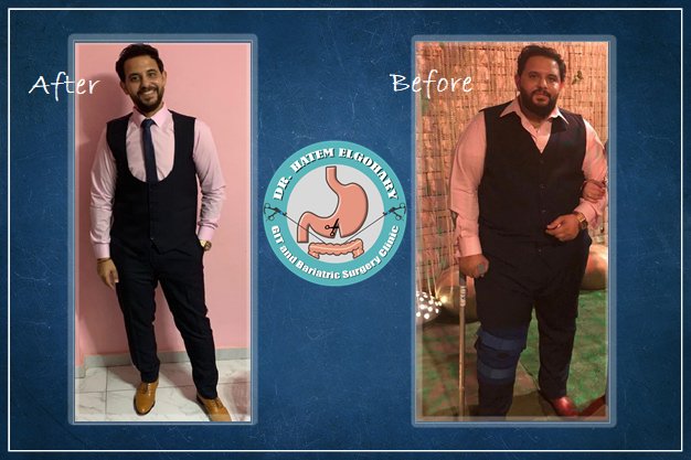 Professor Dr Hatem Elgohary (GIT and Bariatric Surgery) - Professor Dr Hatem Elgohary (GIT and Bariatric Surgery)