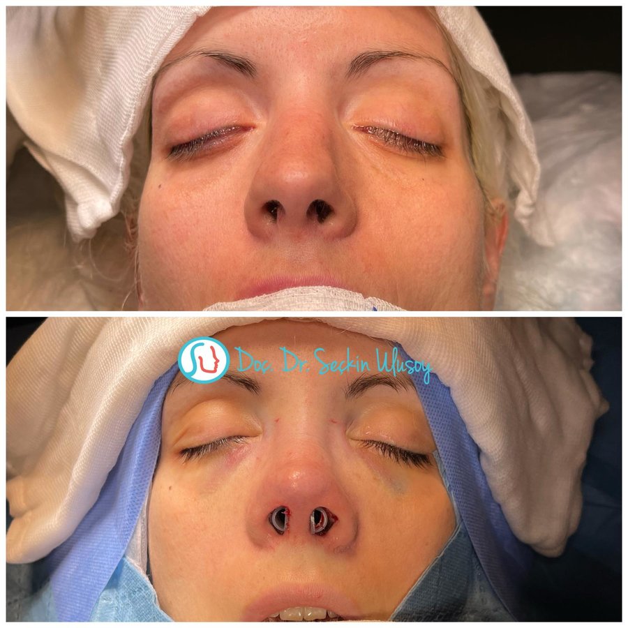 Professor Dr Seckin Ulusoy - Professor Dr Seckin Ulusoy