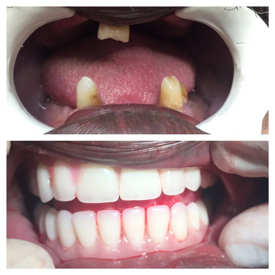 Progreso Smile Dental Center - Progreso Smile Dental Center