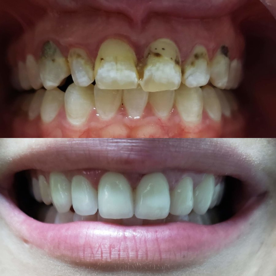 Progreso Smile Dental Center - Progreso Smile Dental Center