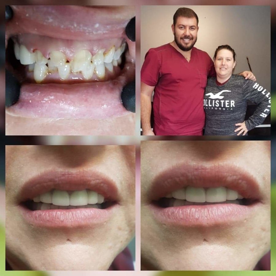 Progreso Smile Dental Center - Progreso Smile Dental Center