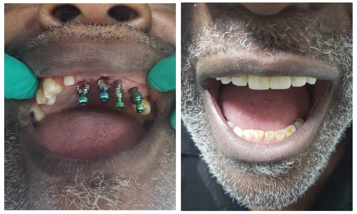 Progreso Smile Dental Center - Progreso Smile Dental Center