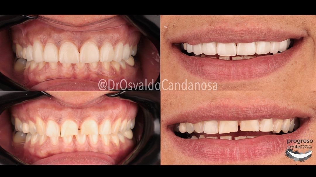 Progreso Smile Dental Center - Progreso Smile Dental Center