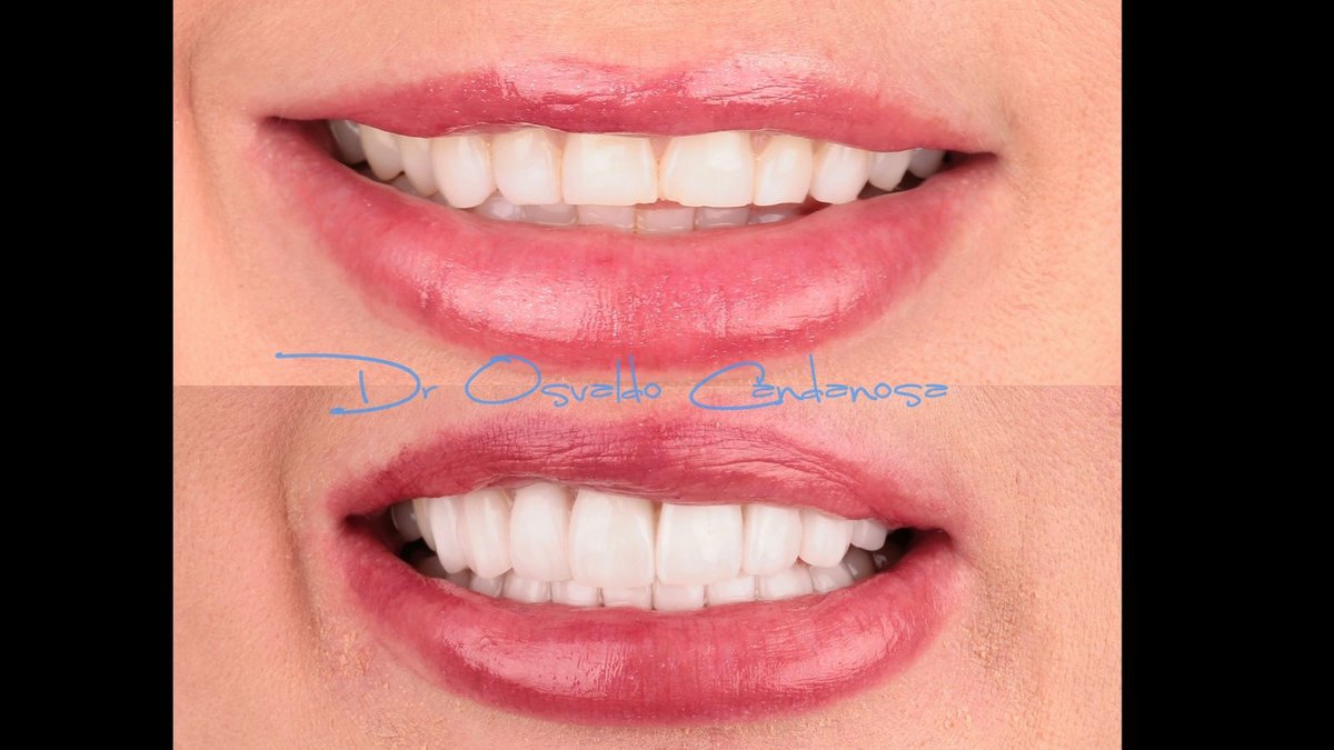 Progreso Smile Dental Center - Progreso Smile Dental Center