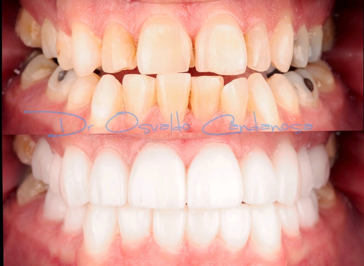 Progreso Smile Dental Center - Progreso Smile Dental Center