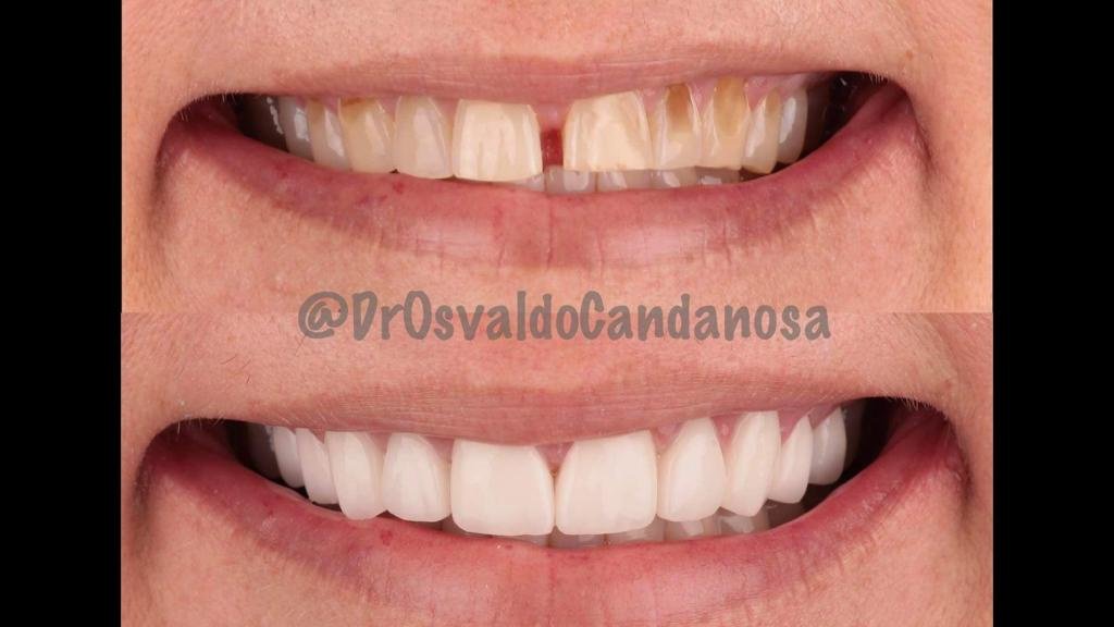 Progreso Smile Dental Center - Progreso Smile Dental Center