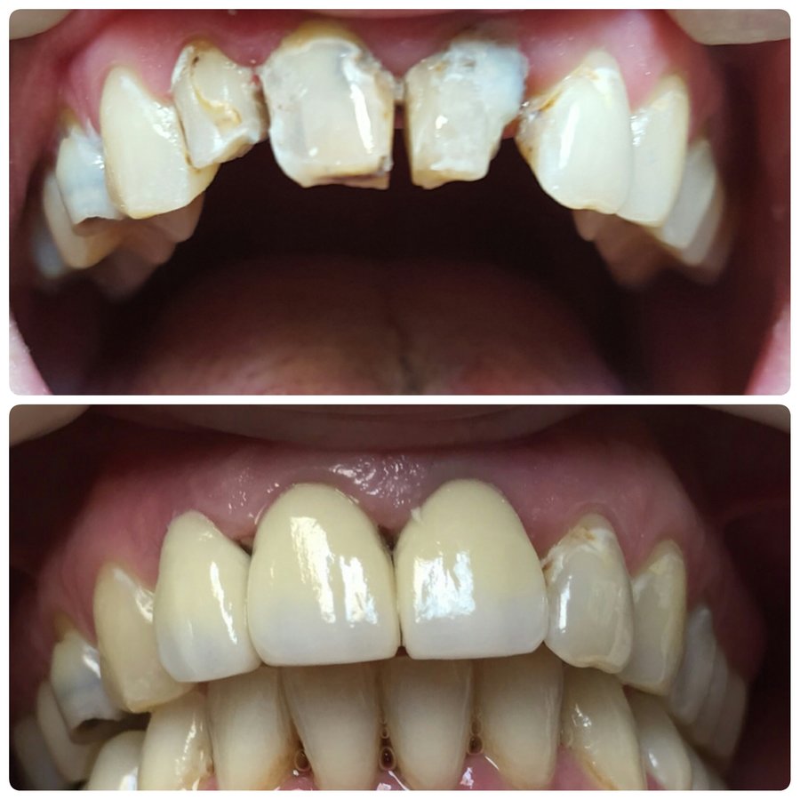 Progreso Smile Dental Center - Progreso Smile Dental Center