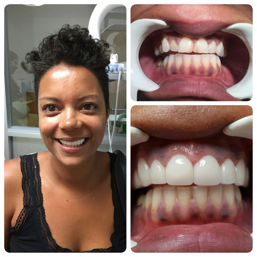 Progreso Smile Dental Center - Progreso Smile Dental Center