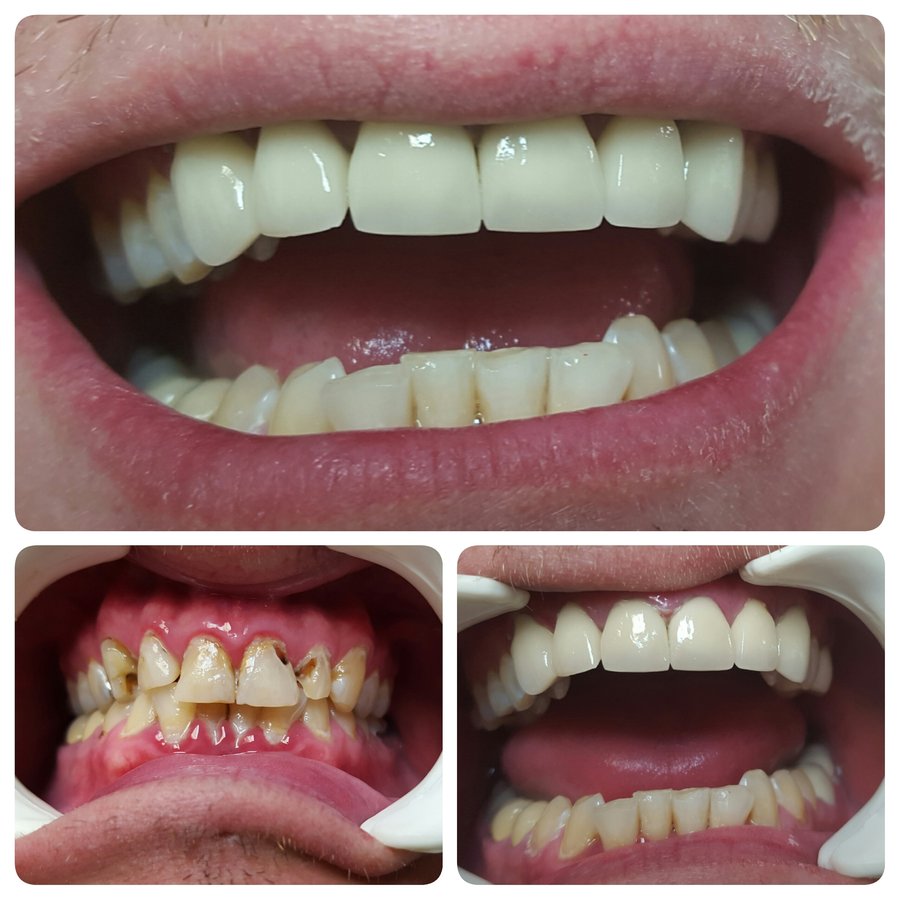 Progreso Smile Dental Center - Progreso Smile Dental Center