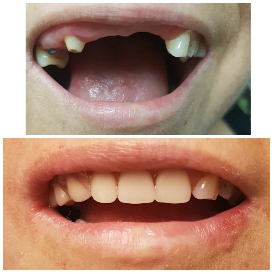 Progreso Smile Dental Center - Progreso Smile Dental Center