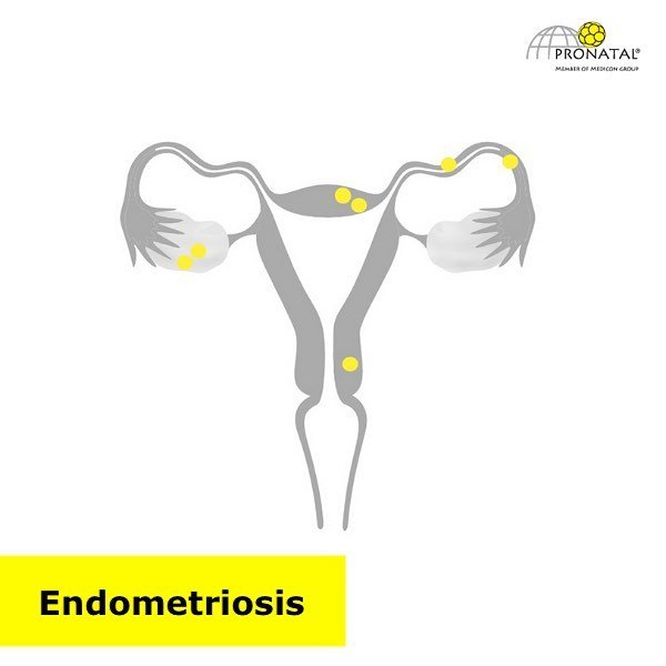 PRONATAL Plus - PRONATAL Plus