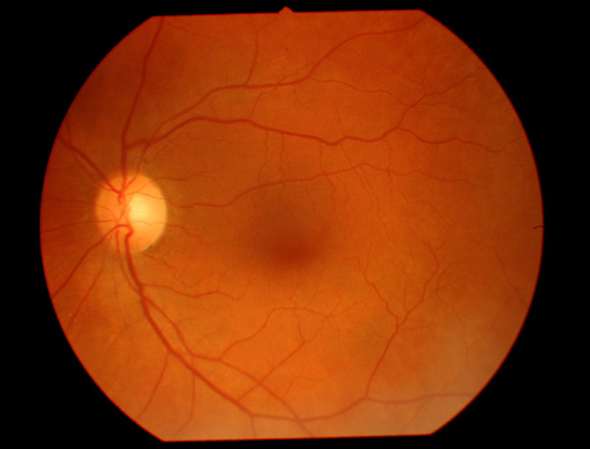 عيادة بروسكان للعيون - Proscan EyeCare Clinic