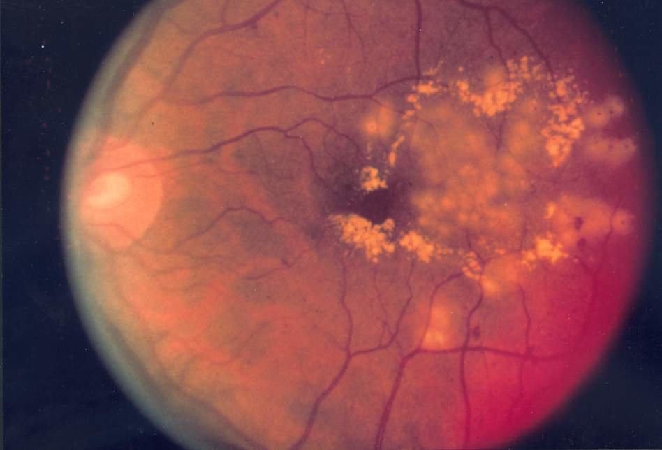 عيادة بروسكان للعيون - Proscan EyeCare Clinic