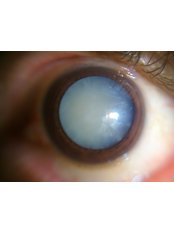 عيادة بروسكان للعيون - Proscan EyeCare Clinic