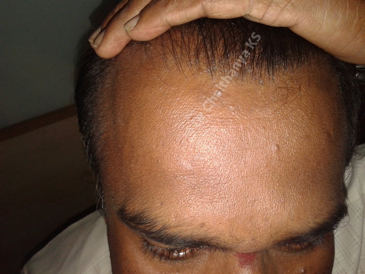 Psoriasis Clinic - Psoriasis Clinic