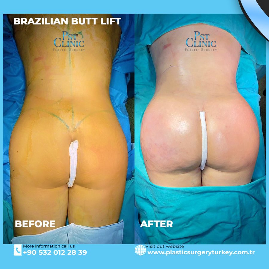 PST clinic - PST clinic