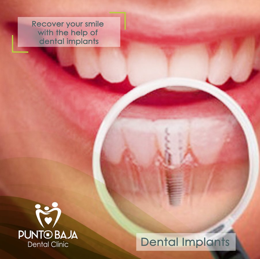 Punto Baja Dental Clinic - Punto Baja Dental Clinic