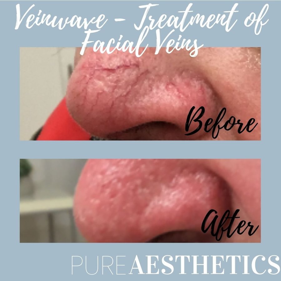 Pure Aesthetics Clinic - Pure Aesthetics Clinic