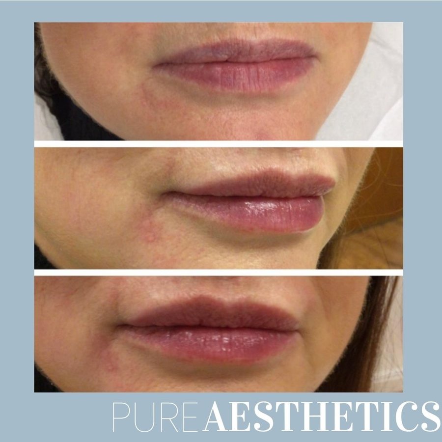Pure Aesthetics Clinic - Pure Aesthetics Clinic