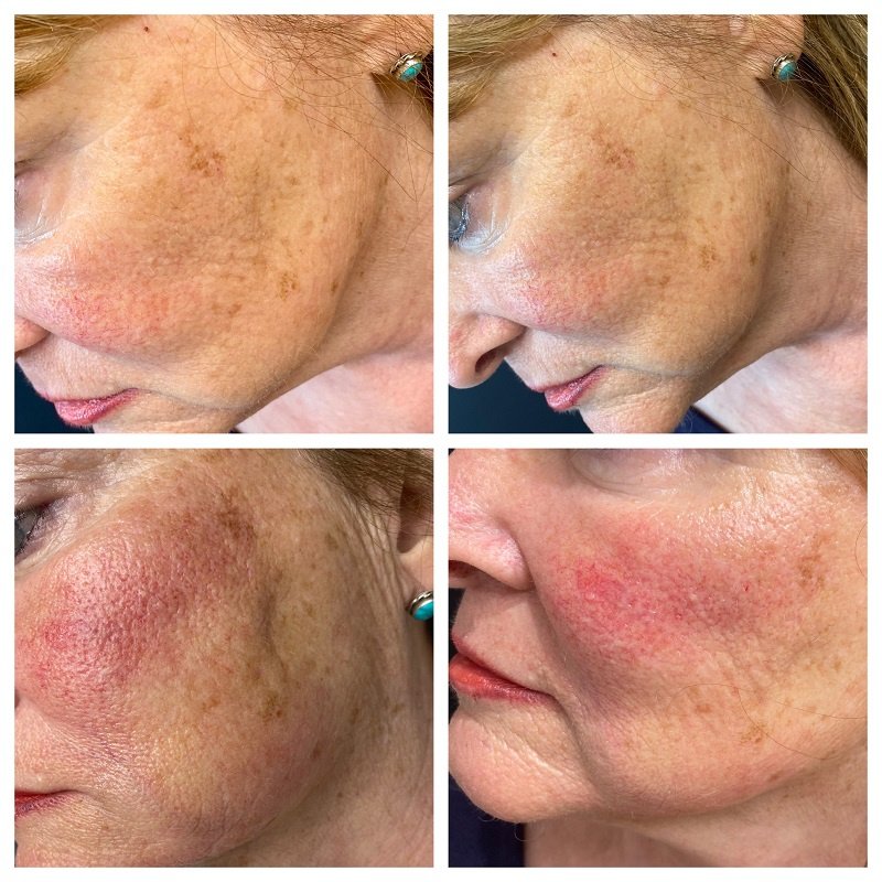 Pure Aesthetics Clinic - Pure Aesthetics Clinic