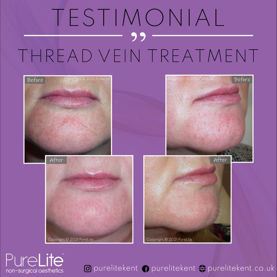 PureLite Non Surgical Aesthetics - PureLite Non Surgical Aesthetics