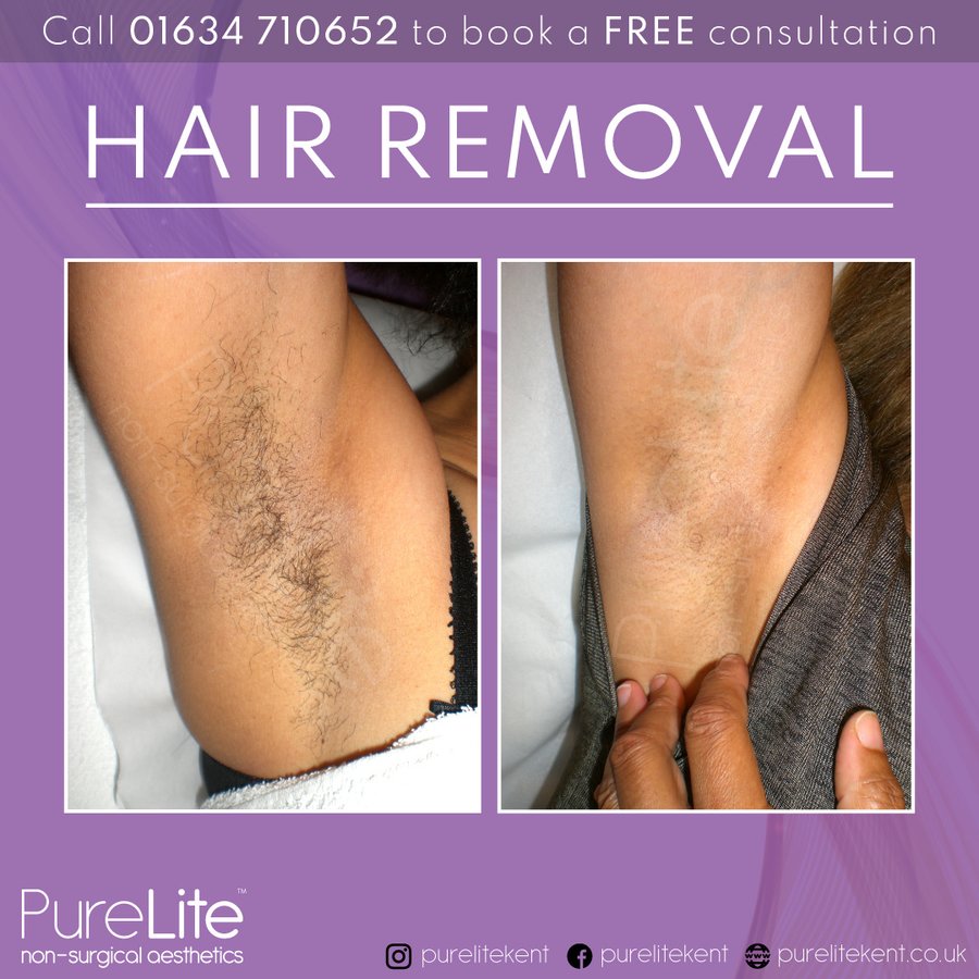 PureLite Non Surgical Aesthetics - PureLite Non Surgical Aesthetics