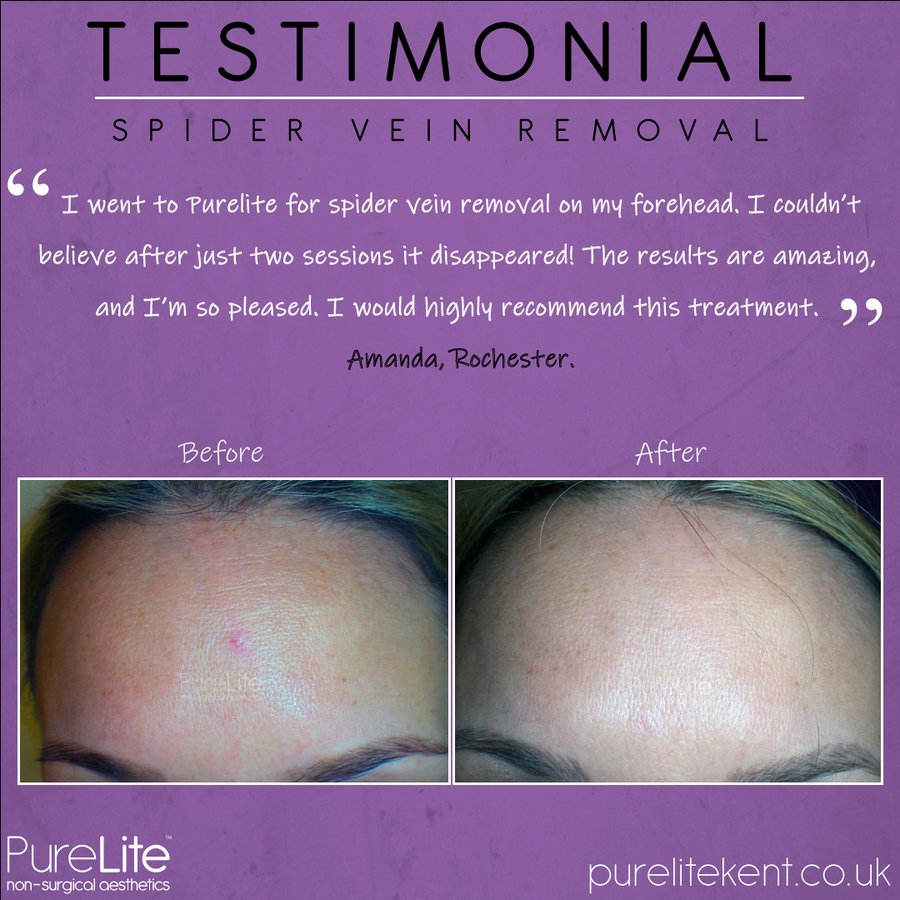 PureLite Non Surgical Aesthetics - PureLite Non Surgical Aesthetics