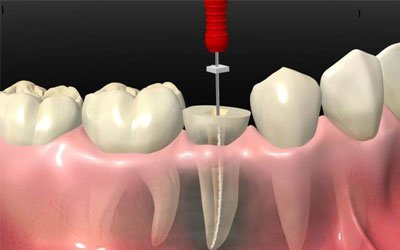 Pushpa Dental Speciality Centre - Pushpa Dental Speciality Centre