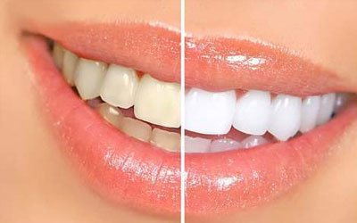 Pushpa Dental Speciality Centre - Pushpa Dental Speciality Centre