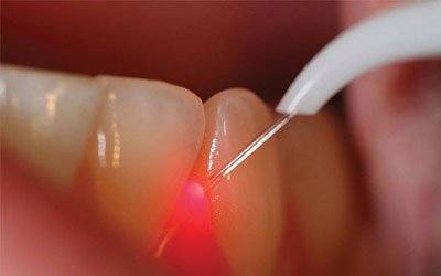 Pushpa Dental Speciality Centre - Pushpa Dental Speciality Centre