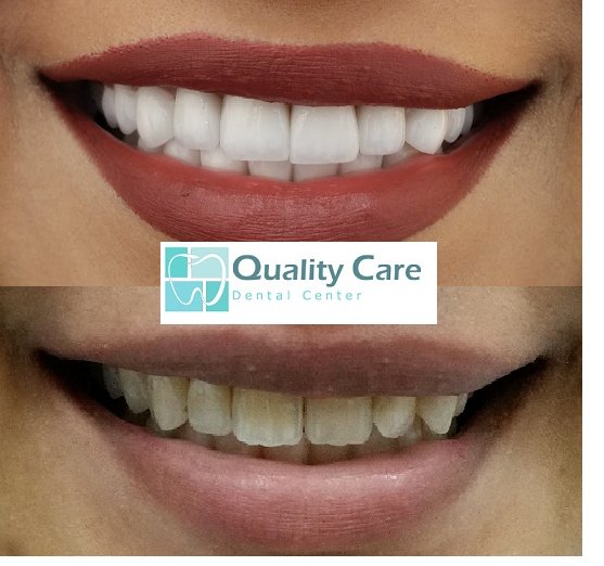 Quality Care Dental Center - Quality Care Dental Center