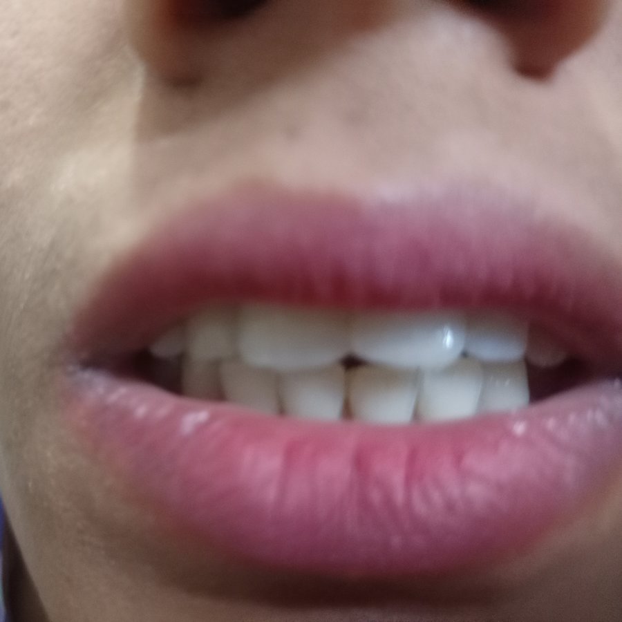 Quality Dental Cares - Quality Dental Cares