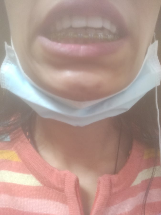 Quality Dental Cares - Quality Dental Cares