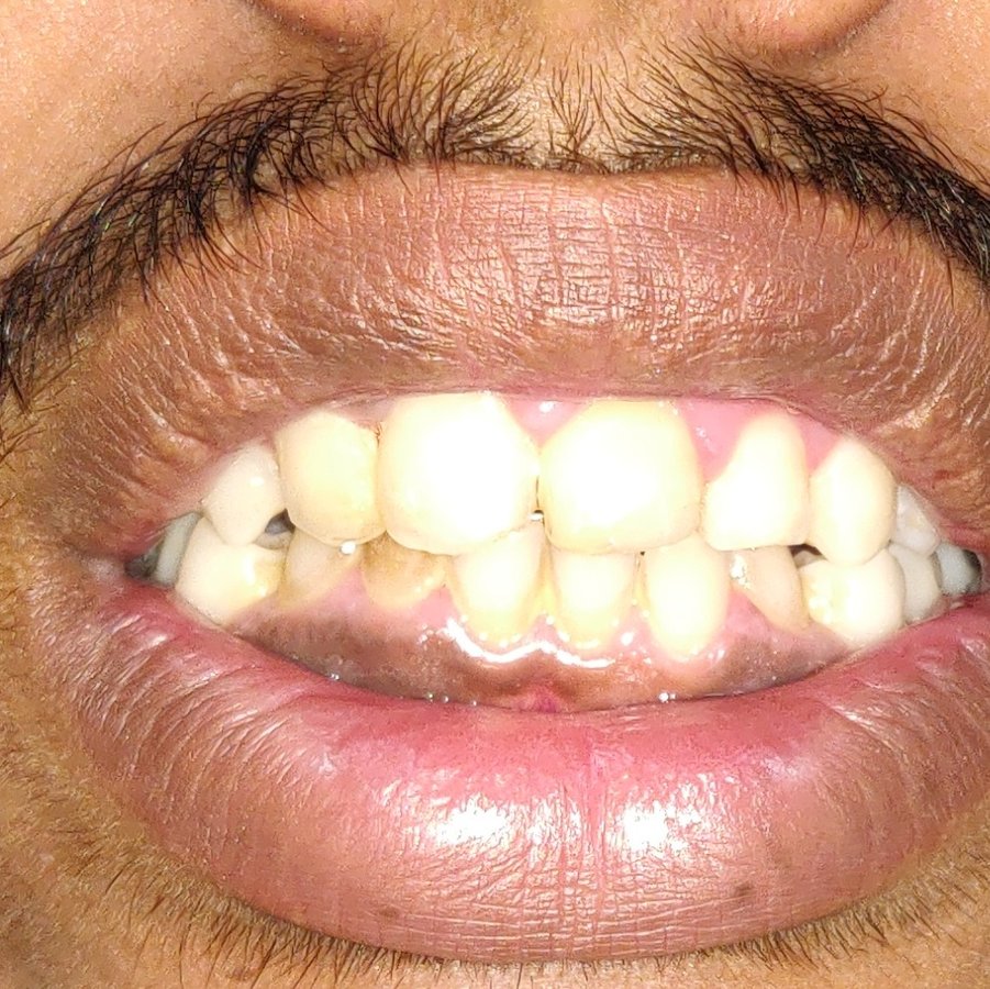 Quality Dental Cares - Quality Dental Cares